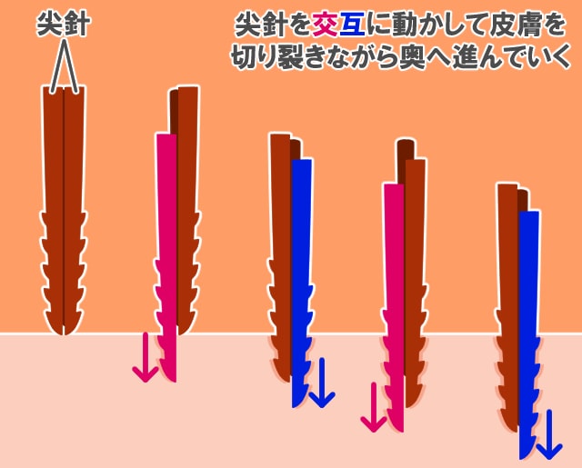 ミツバチの針の特徴が丸わかり 最低限知っておきたい3つの特徴 ハチ110番
