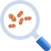 トキソプラズマ